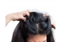 Shampoo Antiforfora